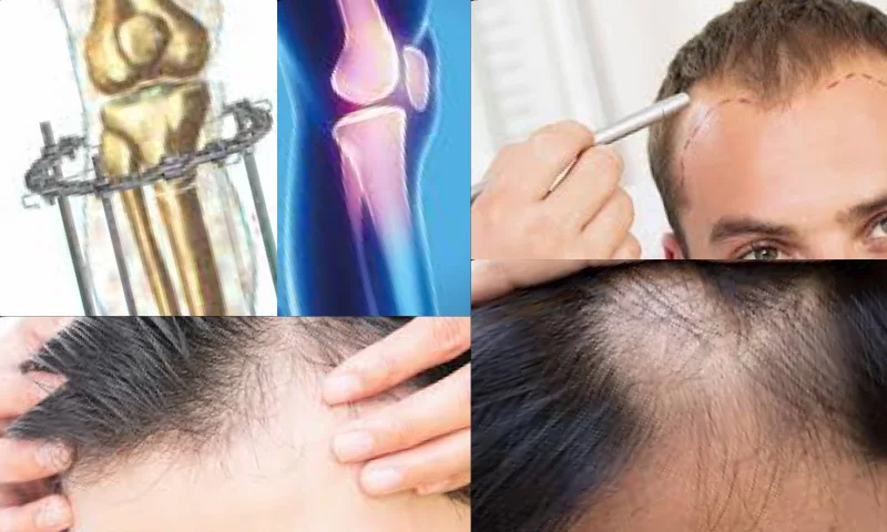 Hair Clinic Saç Kliniği