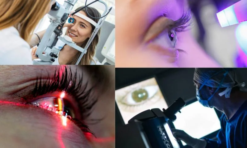 Lazer Göz Tedavisi Nedir ve Nasıl Uygulanır?
