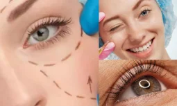 Alt Göz Kapağı Estetiği Sonrası Şişlik ve Morluk Olur Mu?