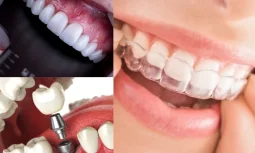 Diş Kliniği Seçerken Dikkat Edilmesi Gerekenler Neden Önemlidir?