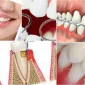 Periodontoloji İle Diş Eti Sorunlarından Kurtulun